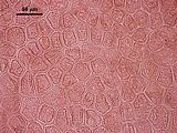 5 - Cellule corticali di una porzione apicale in visione superficiale